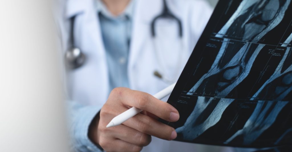 Doctor, x-way, läkare