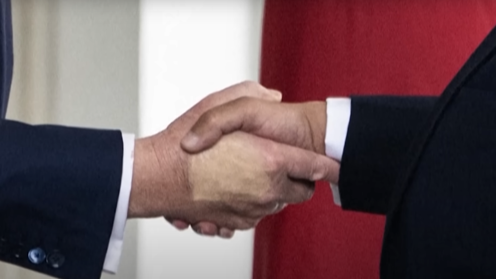 donald trump bruise hand