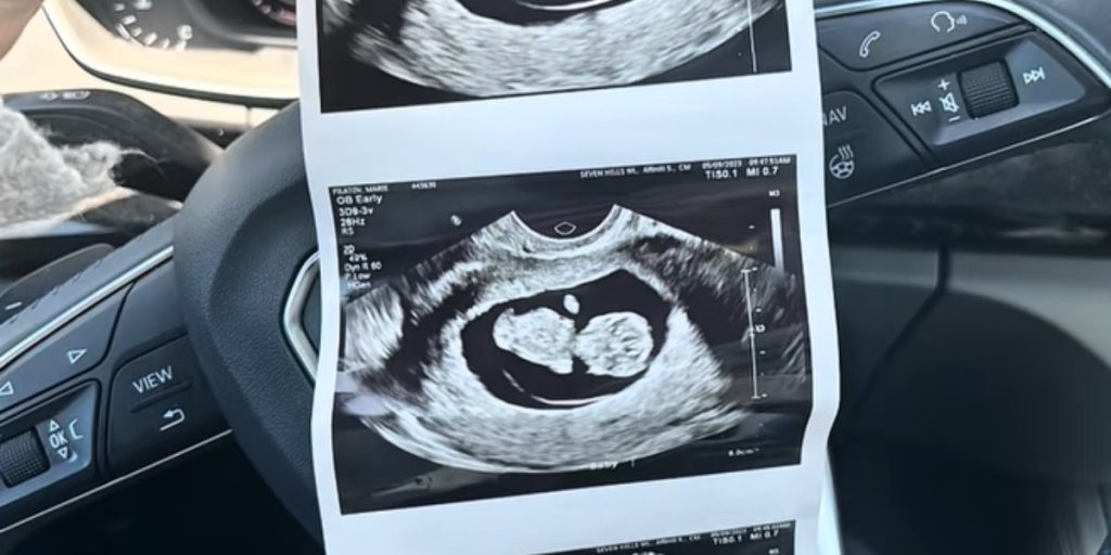 Gravid kvinde tager til scanning på hospitalet: Er fuldstændig i chok over, hvad babyen mangler