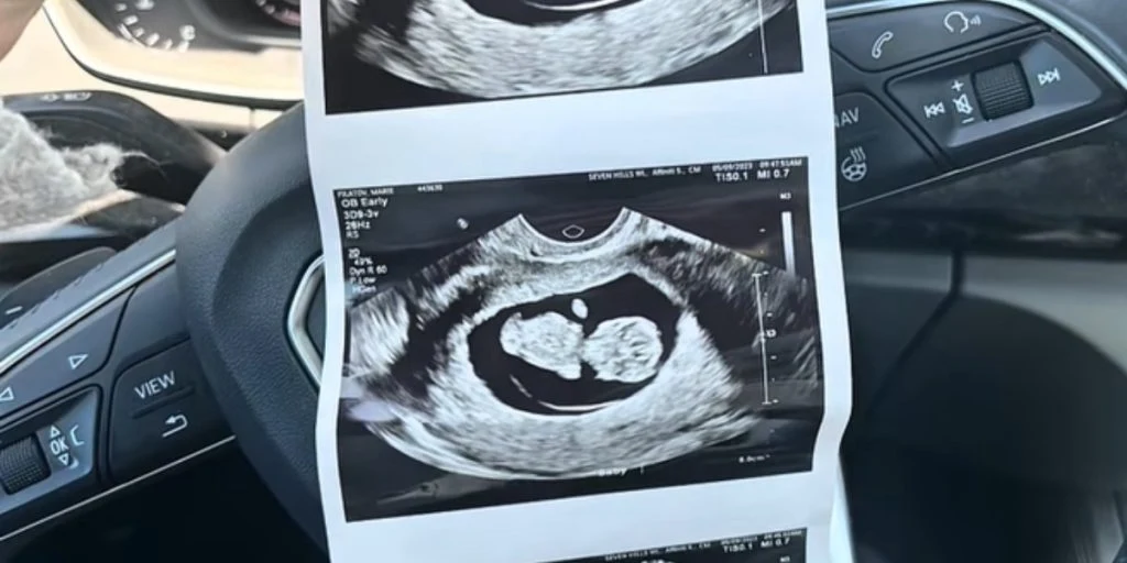 Gravid kvinde tager til scanning på hospitalet: Er fuldstændig i chok over, hvad babyen mangler