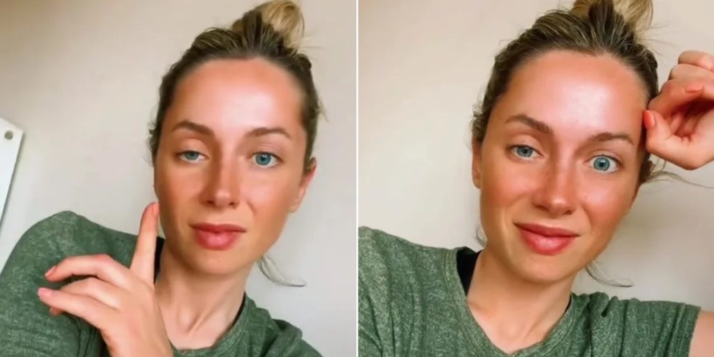 Kvinde har fået Botox i årevis: Men ved den seneste behandling gik det helt galt