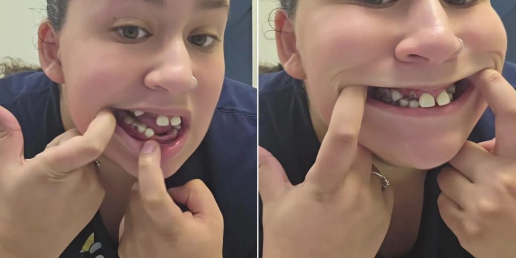 Mor bruger sig selv som skræmmeeksempel: Det sker der, hvis dine børn ikke børster tænder