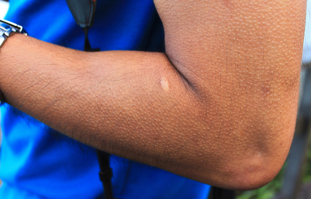 Derfor får du gåsehud når du blir redd – eller rørt