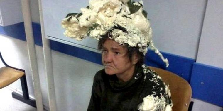 Kvinde blev indlagt på hospitalet, efter at hun forvekslede byggeskum med hårmousse