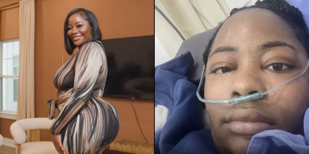 Influencer rejste til Mexico for en billig numseoperation: Det var tæt på at koste hende livet