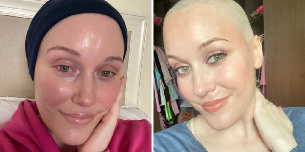 Kræftpatient blev kontaktet af fremmed i indkøbscenter: Nu går hendes reaktion viralt