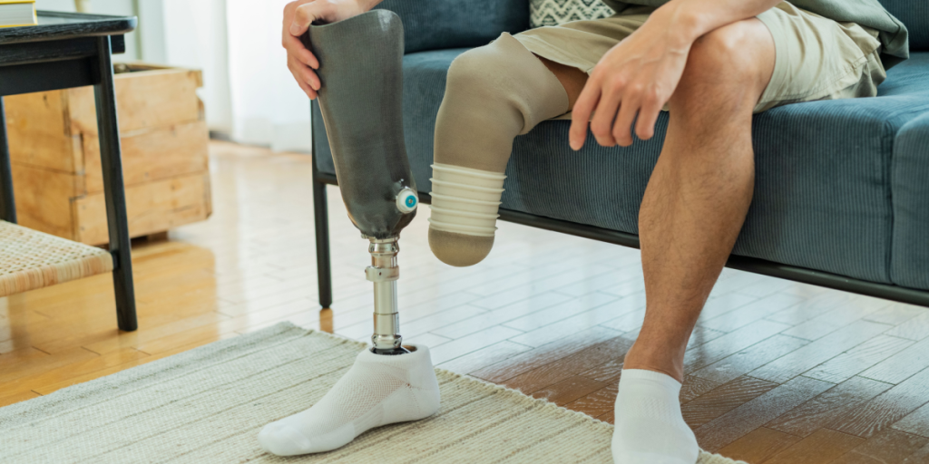 Hur mycket Ryssland spenderar på proteser talar mycket om deras förluster i Ukraina