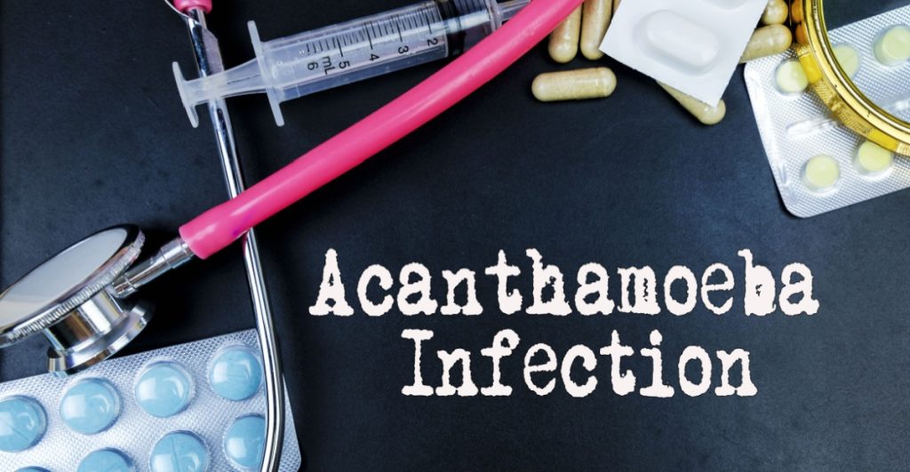 Acanthamoeba Infection