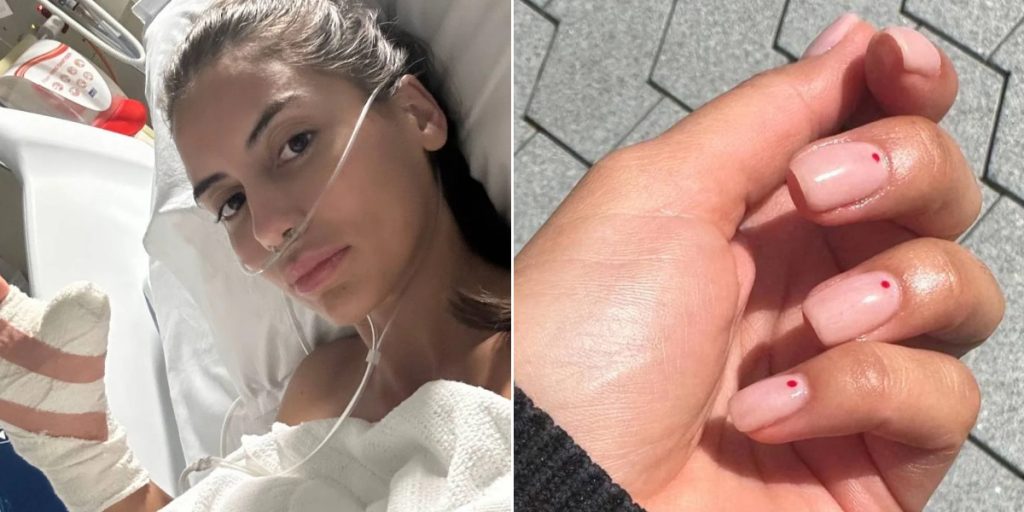 Hun fik en manicure af ‘doven’ negletekniker: Så fik hun brug for 6 operationer