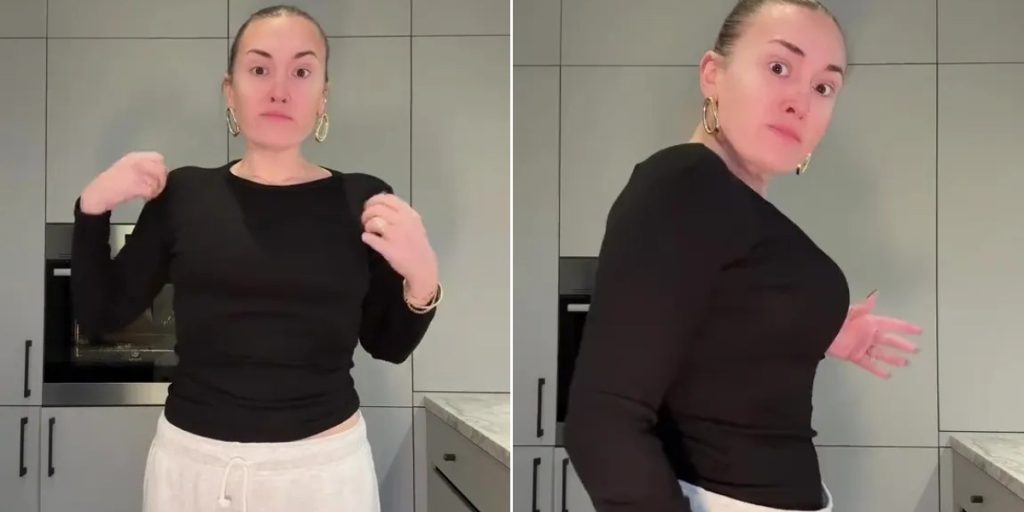 Hun har tabt sig 57 kg med slankesprøjter: Men nu har hun brug for operation