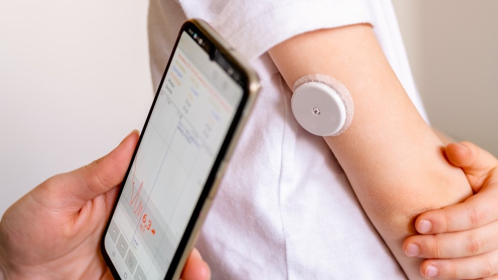 glucose sensors diabetes