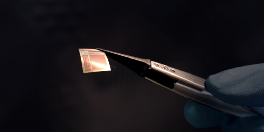 Video: Neues Gehirnimplantat könnte die Behandlung von Epilepsie, Schlaganfall und ALS revolutionieren