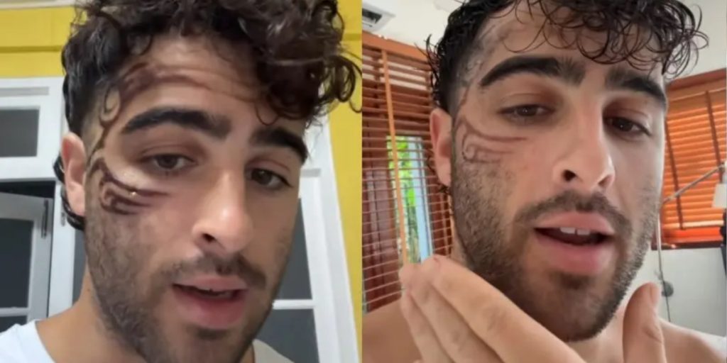 Ung mand fik sjov henna-tattoo på ferie: Det endte med at gå helt galt