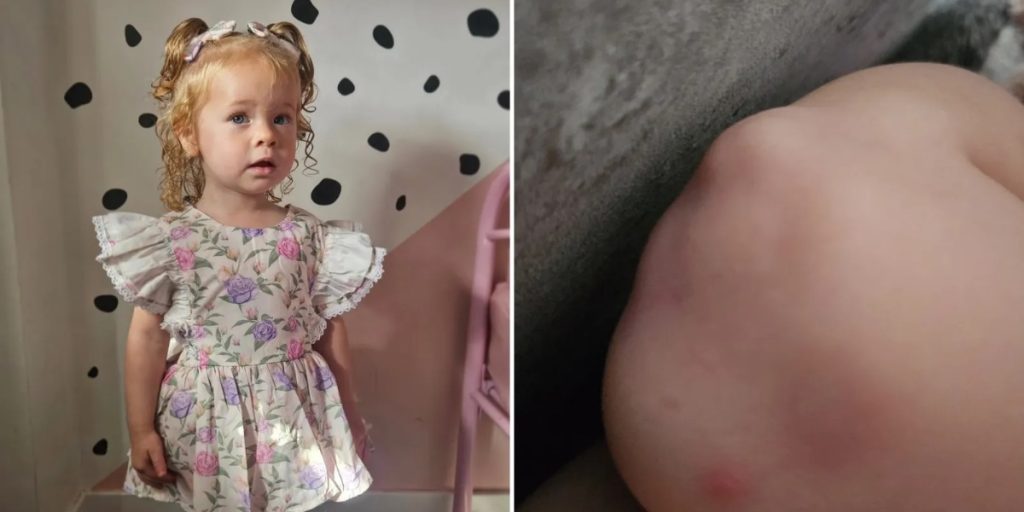 Lægerne afviste det som vokseværk: Men sandheden om lille piges smerter var en helt anden