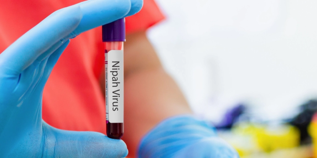 Nipah virus