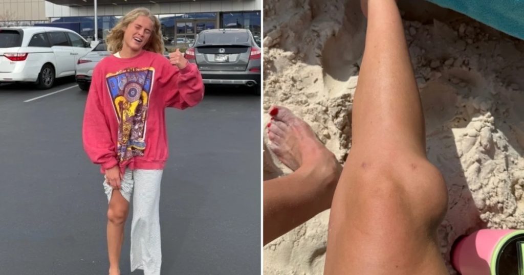 Kvinde træner op til tre maratonløb: Så sker der noget uventet med hendes knæ