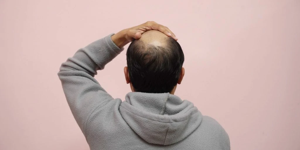 Baldness balding man moon