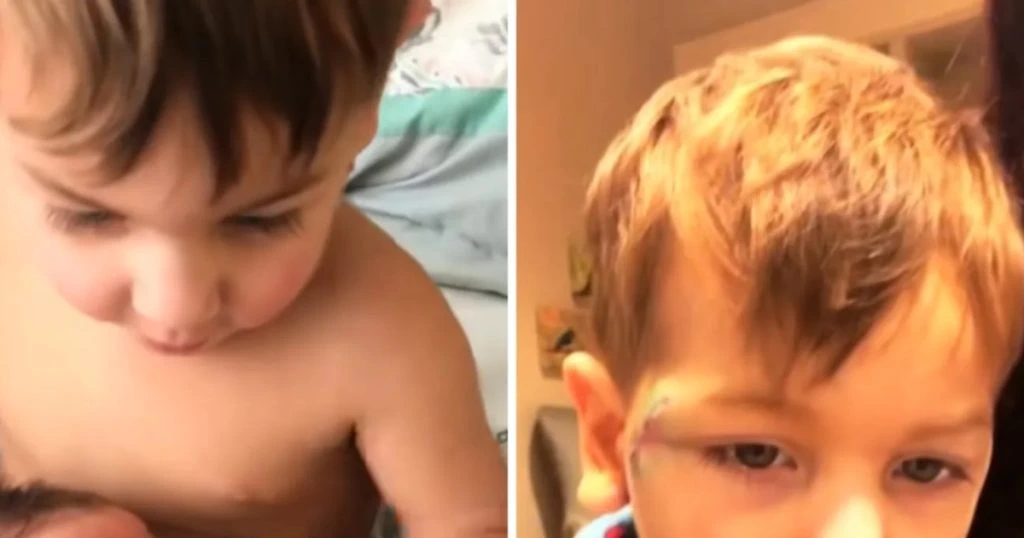 Mor opdagede en plet på barns ansigt: Hendes mavefornemmelse reddede hans liv