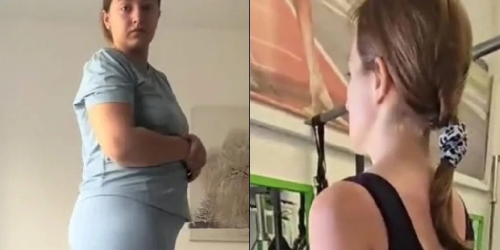 27-årig kvinde tabte 38 kg med slankemedicin – men én ting er hun ikke tilfreds med