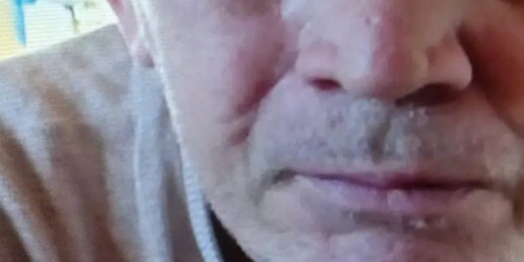 Politiet med bekymrende efterlysning: “Vi frygter, at han ikke kan tage vare på sig selv”