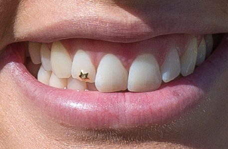 Tooth jewelry is trending, but is it safe?