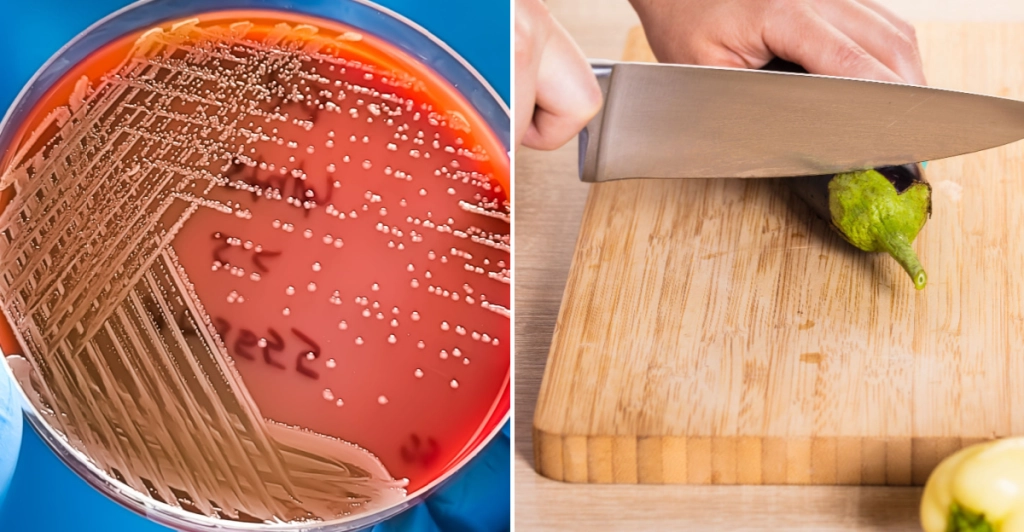 Experten varnar: Så vet du när skärbrädan måste slängas