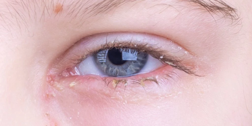 Folk er i chok efter at have hørt svaret: Det er det gule “søvn”, du vågner med i øjenkrogen