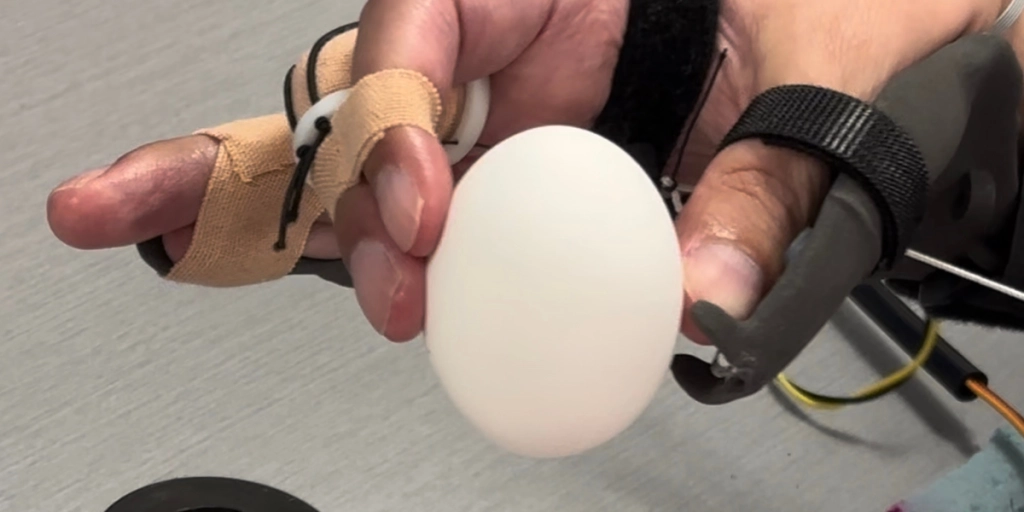 AI brain implant, paralyzed man, Northwell Health