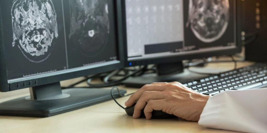 Doctor using computer to analyzing brain MRI in radiology room of the hospital