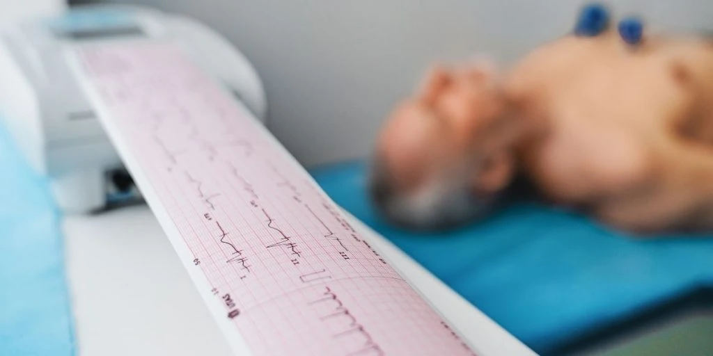 ECG. Cardiogram printout on male patient background. Checking on pulse rate heart disease in hospital. Arrhythmia. Cardiac attack. Cardiology concept