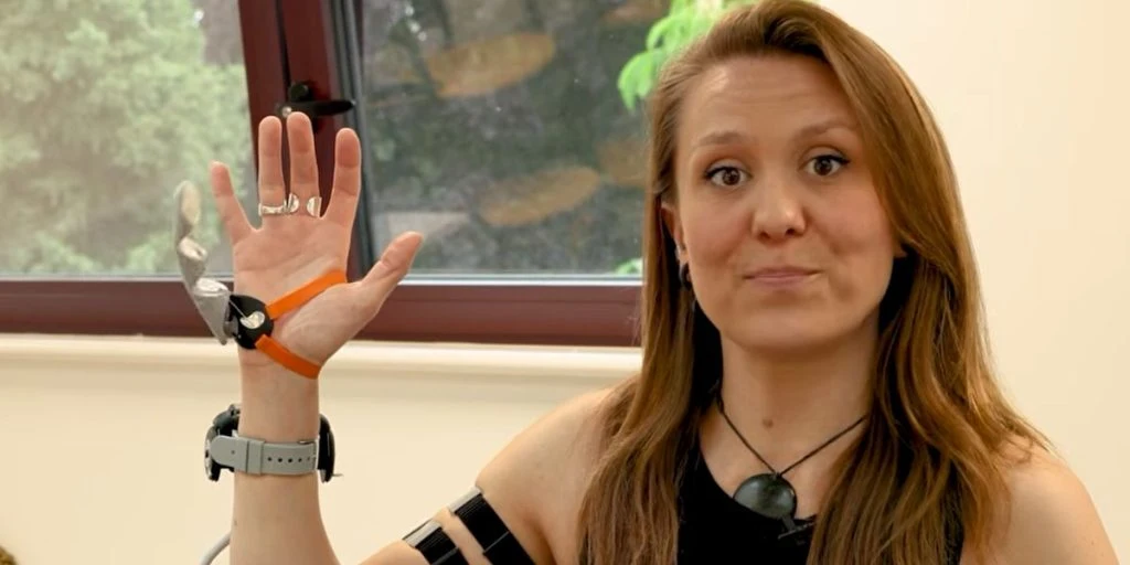 Dani Clode with an extra finger