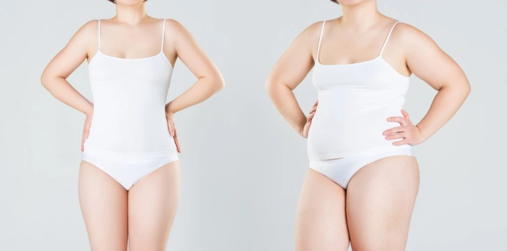 Woman's,Body,Before,And,After,Weight,Loss,On,overvekt, overvægt, slank, diet, tykk og tynn kropp, tyk og tynd krop